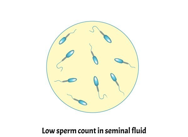 Low,Sperm,Count,In,Seminal,Fluid.,Low,Abundance,Of,Sperm