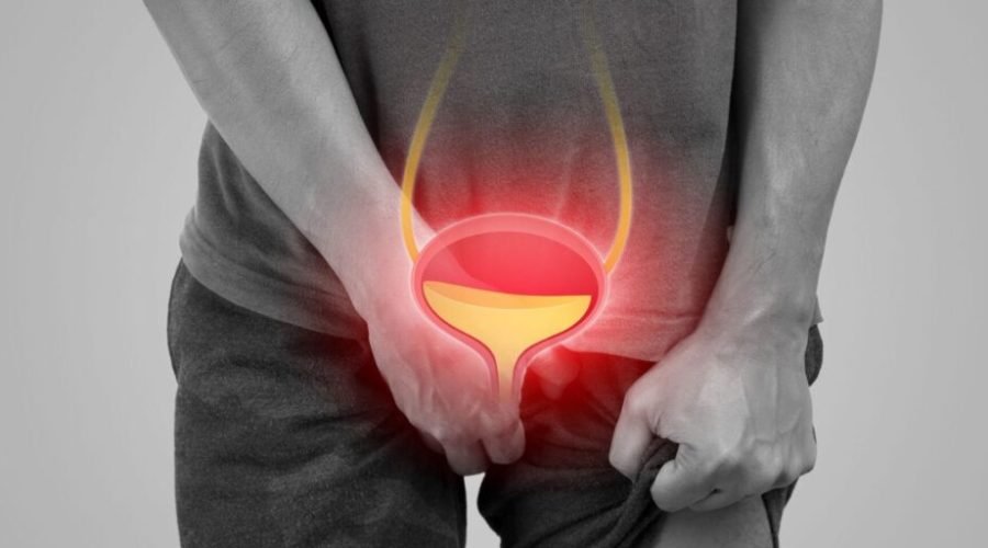 Bladder-Stones-credit-Tharakorn-iStock-1478557925-1024x512